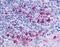 C-C chemokine receptor type 6 antibody, NLS356, Novus Biologicals, Immunohistochemistry frozen image 