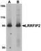 Leucine-rich repeat flightless-interacting protein 2 antibody, TA319772, Origene, Western Blot image 