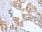 Protein Tyrosine Phosphatase 4A2 antibody, CSB-PA137436, Cusabio, Immunohistochemistry paraffin image 