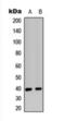 C-X-C Motif Chemokine Receptor 2 antibody, orb393264, Biorbyt, Western Blot image 