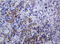Sterol O-Acyltransferase 2 antibody, LS-C175469, Lifespan Biosciences, Immunohistochemistry paraffin image 