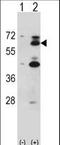 YES Proto-Oncogene 1, Src Family Tyrosine Kinase antibody, LS-C164601, Lifespan Biosciences, Western Blot image 