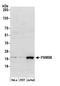 Proteasome subunit beta type-8 antibody, A305-229A, Bethyl Labs, Western Blot image 