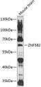 Zinc finger protein 582 antibody, 15-551, ProSci, Western Blot image 