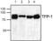 Hydroxyacyl-CoA Dehydrogenase Trifunctional Multienzyme Complex Subunit Alpha antibody, TA318956, Origene, Western Blot image 