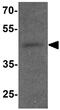 Reticulon 4 Receptor Like 2 antibody, GTX32102, GeneTex, Western Blot image 