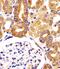Protein VAC14 homolog antibody, M04720, Boster Biological Technology, Immunohistochemistry paraffin image 