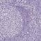 Ring Finger Protein 186 antibody, NBP1-83667, Novus Biologicals, Immunohistochemistry paraffin image 