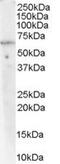Serine/threonine-protein phosphatase 2A 65 kDa regulatory subunit A alpha isoform antibody, MBS420420, MyBioSource, Western Blot image 