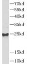 Ubiquitin-conjugating enzyme E2 S antibody, FNab09183, FineTest, Western Blot image 