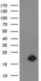 Destrin antibody, NBP2-00527, Novus Biologicals, Western Blot image 