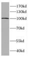 Catenin Alpha 3 antibody, FNab02057, FineTest, Western Blot image 