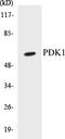 3-Phosphoinositide Dependent Protein Kinase 1 antibody, EKC1449, Boster Biological Technology, Western Blot image 