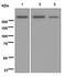 Insulin Like Growth Factor 2 Receptor antibody, ab124767, Abcam, Western Blot image 