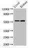 Pancreatic Lipase Related Protein 3 antibody, CSB-PA018265LA01HU, Cusabio, Western Blot image 