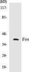 Fos Proto-Oncogene, AP-1 Transcription Factor Subunit antibody, EKC1220, Boster Biological Technology, Western Blot image 
