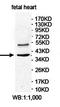 Low Density Lipoprotein Receptor Class A Domain Containing 3 antibody, orb78397, Biorbyt, Western Blot image 