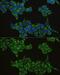 Interferon Regulatory Factor 3 antibody, GTX54366, GeneTex, Immunofluorescence image 