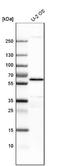YES Proto-Oncogene 1, Src Family Tyrosine Kinase antibody, NBP1-85369, Novus Biologicals, Western Blot image 