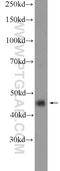 Actin Related Protein 10 antibody, 20101-1-AP, Proteintech Group, Western Blot image 