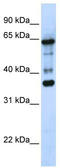 Zinc Finger Protein 630 antibody, TA339658, Origene, Western Blot image 
