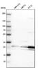 Protein-L-Isoaspartate (D-Aspartate) O-Methyltransferase antibody, PA5-51872, Invitrogen Antibodies, Western Blot image 