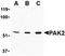 P21 (RAC1) Activated Kinase 2 antibody, orb74748, Biorbyt, Western Blot image 