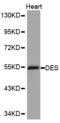 Desmin antibody, LS-C331079, Lifespan Biosciences, Western Blot image 