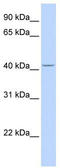 Cytochrome P450 Family 4 Subfamily F Member 12 antibody, TA338641, Origene, Western Blot image 