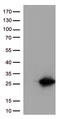 Cancer/Testis Antigen 1B antibody, UM500060, Origene, Western Blot image 