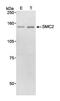 Structural maintenance of chromosomes protein 2 antibody, NB100-371, Novus Biologicals, Western Blot image 