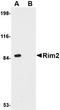 Regulating Synaptic Membrane Exocytosis 2 antibody, orb74991, Biorbyt, Western Blot image 