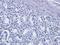CD25 antibody, orb348865, Biorbyt, Immunohistochemistry paraffin image 