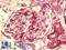 Zinc Finger MYM-Type Containing 1 antibody, LS-B9512, Lifespan Biosciences, Immunohistochemistry paraffin image 