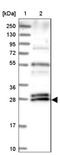 Chromosome 10 Open Reading Frame 67 antibody, NBP1-81068, Novus Biologicals, Western Blot image 