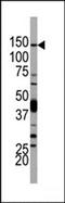 Phosphatidylinositol-4,5-bisphosphate 3-kinase catalytic subunit delta isoform antibody, TA325015, Origene, Western Blot image 