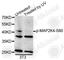 Mitogen-Activated Protein Kinase Kinase 4 antibody, AP0067, ABclonal Technology, Western Blot image 
