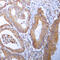 Acetyl-CoA Carboxylase Alpha antibody, GTX54946, GeneTex, Immunohistochemistry paraffin image 