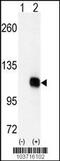 Diacylglycerol Kinase Zeta antibody, 63-371, ProSci, Western Blot image 