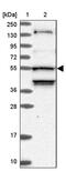Serine/threonine-protein kinase 38-like antibody, PA5-58471, Invitrogen Antibodies, Western Blot image 