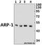 Nuclear Receptor Subfamily 2 Group F Member 2 antibody, A02420T7, Boster Biological Technology, Western Blot image 
