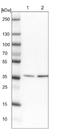 Aminolevulinate Dehydratase antibody, NBP1-89157, Novus Biologicals, Western Blot image 