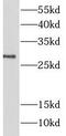 Lin-7 Homolog A, Crumbs Cell Polarity Complex Component antibody, FNab04788, FineTest, Western Blot image 