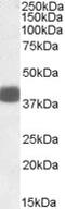 F-box only protein 32 antibody, ab92281, Abcam, Western Blot image 