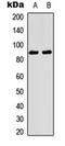 Neurotrophic Receptor Tyrosine Kinase 1 antibody, orb315639, Biorbyt, Western Blot image 