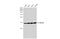 Ribosomal Protein L22 antibody, GTX130972, GeneTex, Western Blot image 