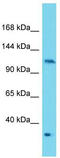 Serine/threonine-protein kinase N2 antibody, TA343178, Origene, Western Blot image 