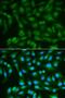 SDH antibody, LS-C331907, Lifespan Biosciences, Immunofluorescence image 