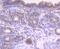 SMAD2 antibody, A00090S255, Boster Biological Technology, Immunohistochemistry paraffin image 