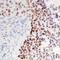 Jun Proto-Oncogene, AP-1 Transcription Factor Subunit antibody, LS-C368398, Lifespan Biosciences, Immunohistochemistry paraffin image 